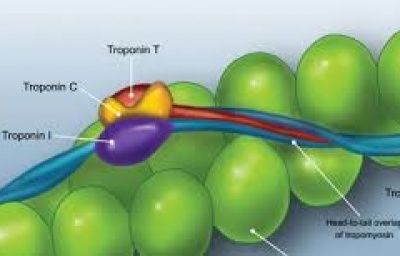 Sử dụng xét nghiệm Troponin I độ nhạy cao trong chẩn đoán nhồi máu cơ tim cấp - Thông tin đồng thuận từ Ban cố vấn